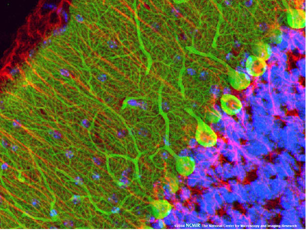 Resultado de imagen de elementos protoplasmáticos, observables a través del microscopio, son, esencialmente, una manifestación aparente y externa de determinadas relaciones de solubilidad